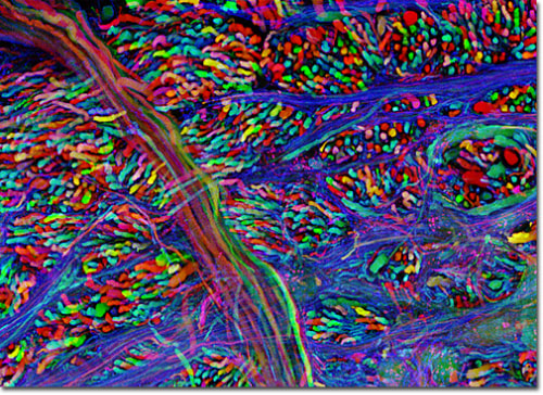 image of a brainbow